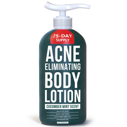 TreeActiv Acne Eliminating Body Lotion 8 fl oz front view