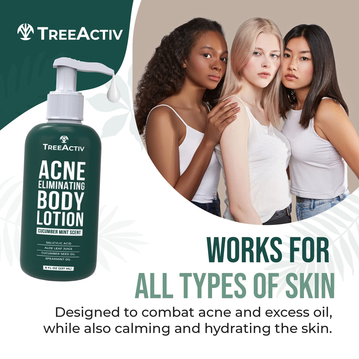TreeActiv Acne Eliminating Body Lotion 8 fl oz side view