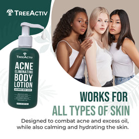TreeActiv Acne Eliminating Body Lotion 8 fl oz side view