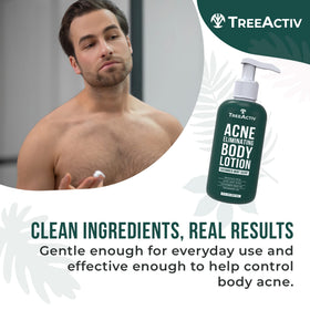 TreeActiv Acne Eliminating Body Lotion 8 fl oz with aloe vera ingredients