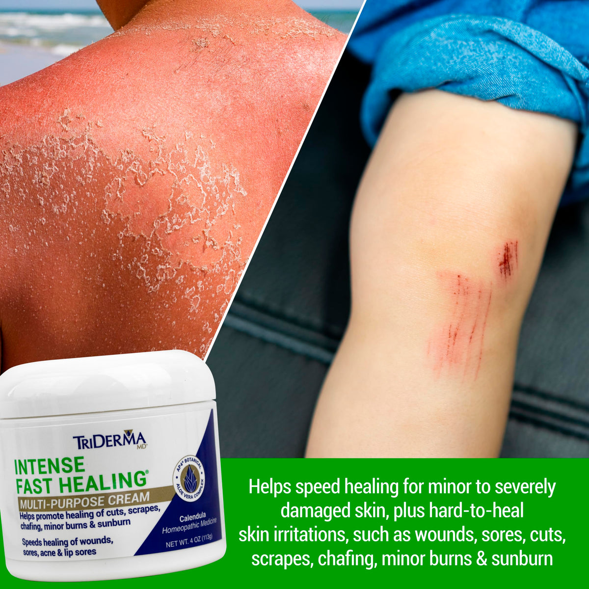 TriDerma Intense Fast Healing Cream 4oz back view