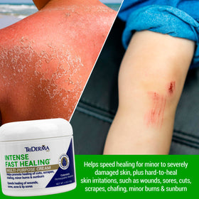 TriDerma Intense Fast Healing Cream 4oz back view