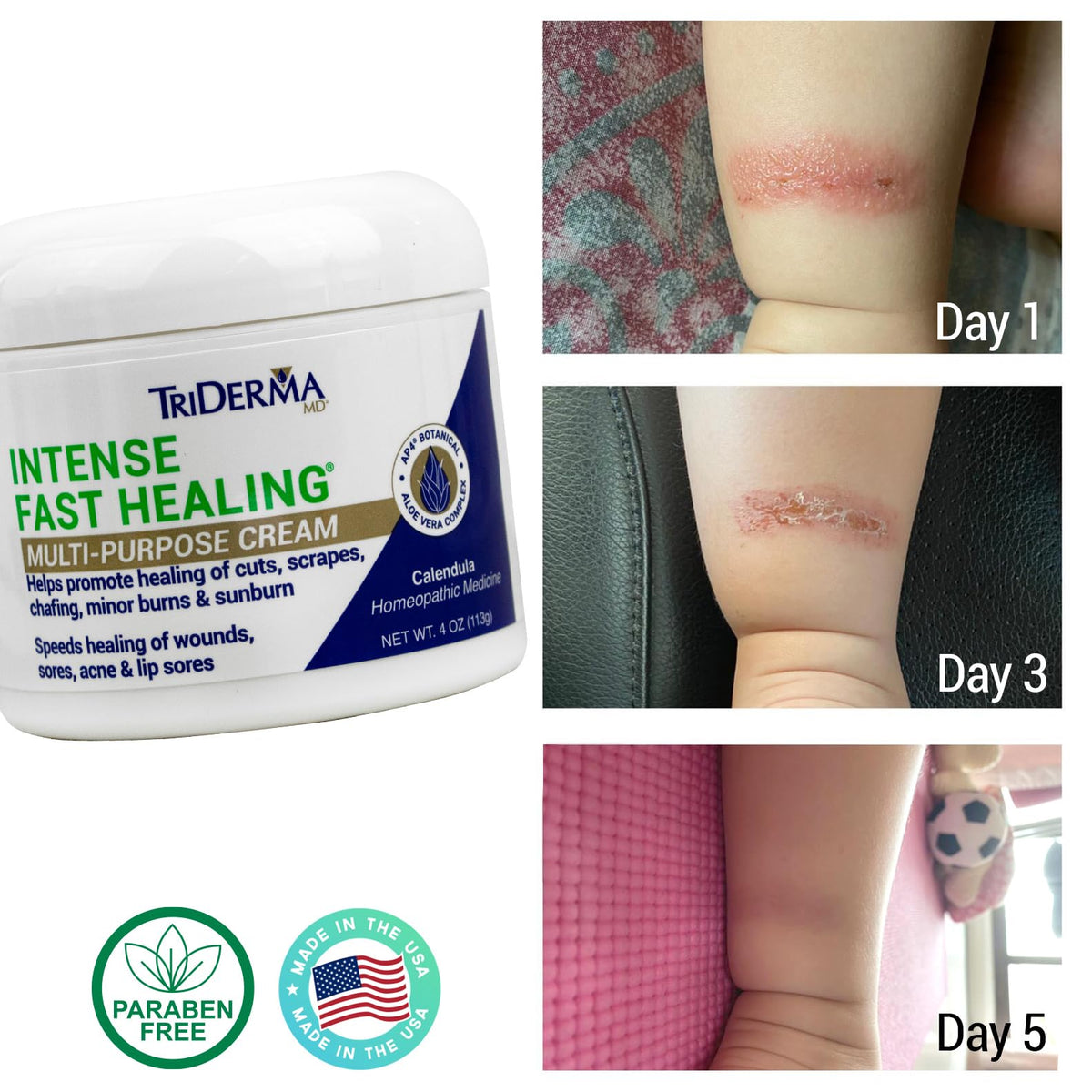 TriDerma Intense Fast Healing Cream 4oz side view