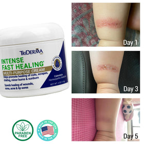 TriDerma Intense Fast Healing Cream 4oz side view