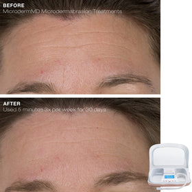 Trophy Skin MicrodermMD packaging and instructions
