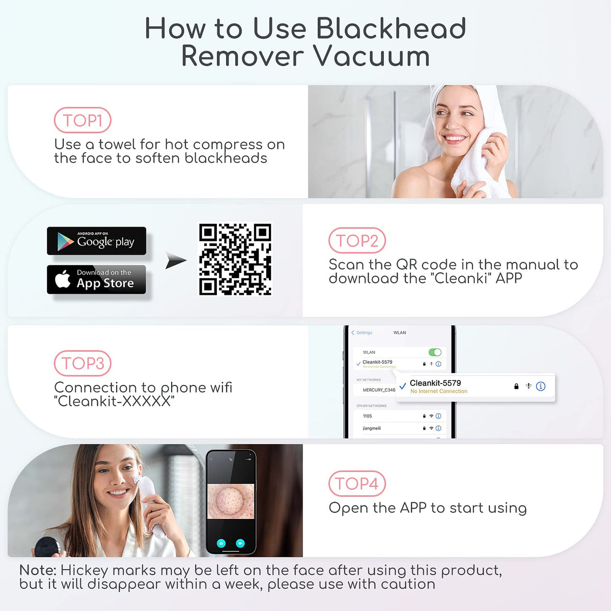TTozka Blackhead Remover Vacuum kit with tools laid out