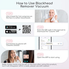 TTozka Blackhead Remover Vacuum kit with tools laid out