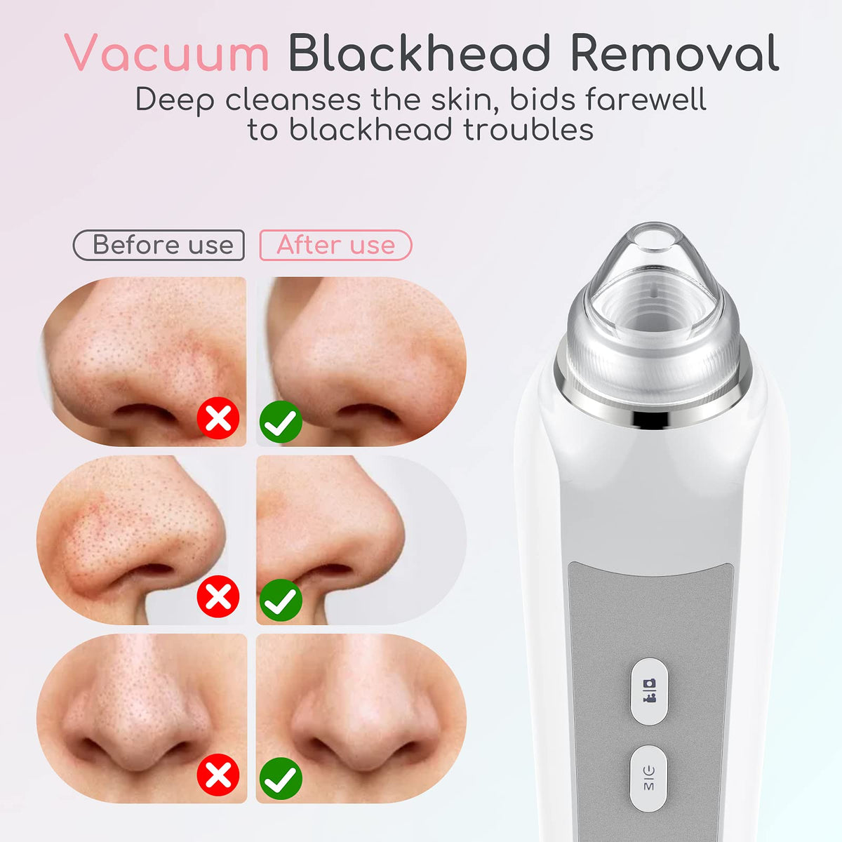 TTozka Blackhead Remover Vacuum with app interface on smartphone