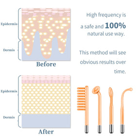 TUMAKOU High Frequency Facial Machine mushroom tube close-up