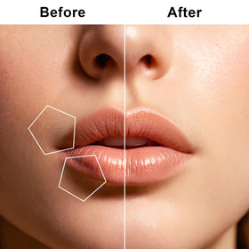 tuokiy Facial Hair Removal with LED light feature in use