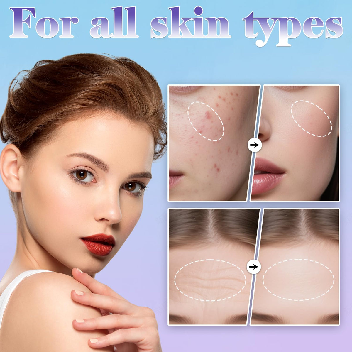 Uaike Derma Stamp microneedling tool in packaging