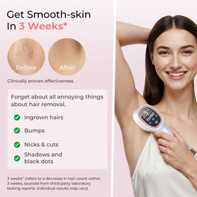 Ubroo IPL Laser Hair Removal Device side view with energy settings