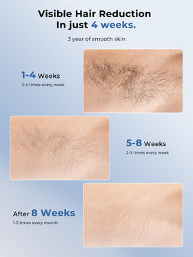 Ubroo Laser Hair Removal Device in use on legs