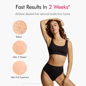 Ulike Air 10 IPL hair removal device in use on legs
