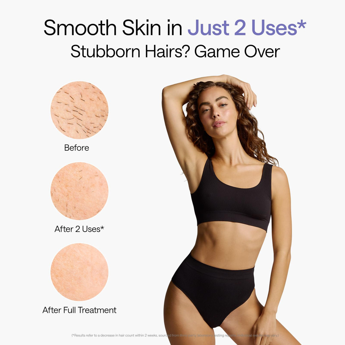 Ulike Air 10 IPL Laser Hair Removal Device area illustration
