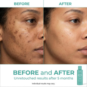 Urban Skin Rx Witch Hazel Brightening Toner on a bathroom counter