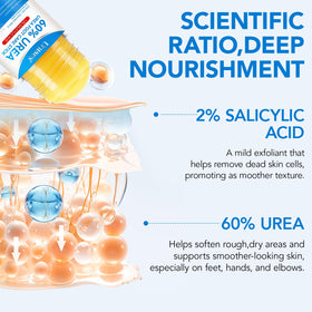 Uruses Urea Cream 60% application on feet