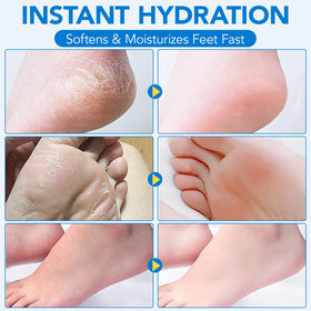 Uruses Urea Cream 60% with ingredients list