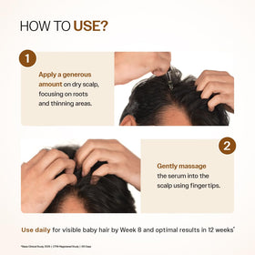 User applying Bare Anatomy Hair Growth Serum