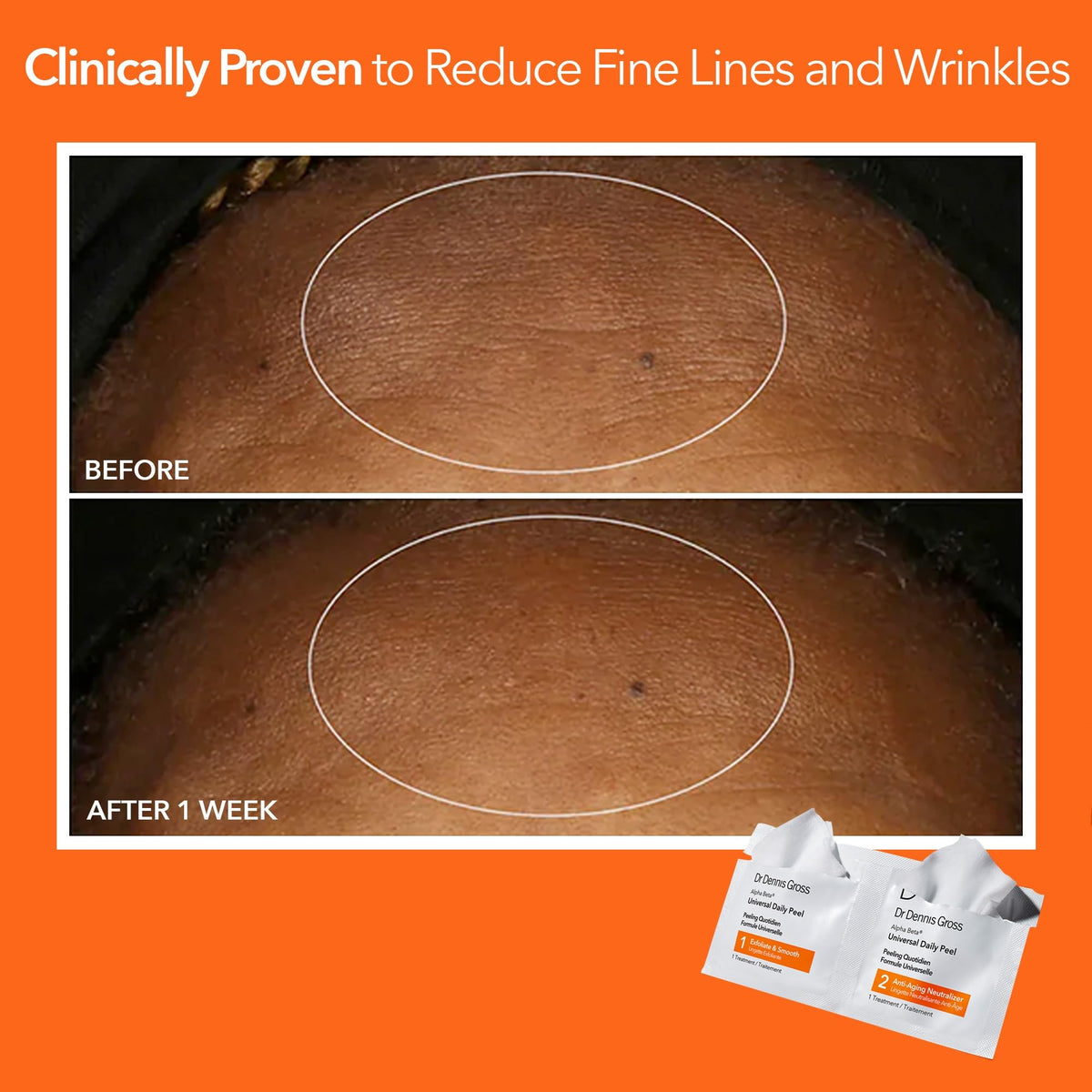 User applying Dr Dennis Gross Alpha Beta Daily Peel