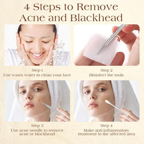 User holding DERMATED blackhead remover tool with ergonomic handle