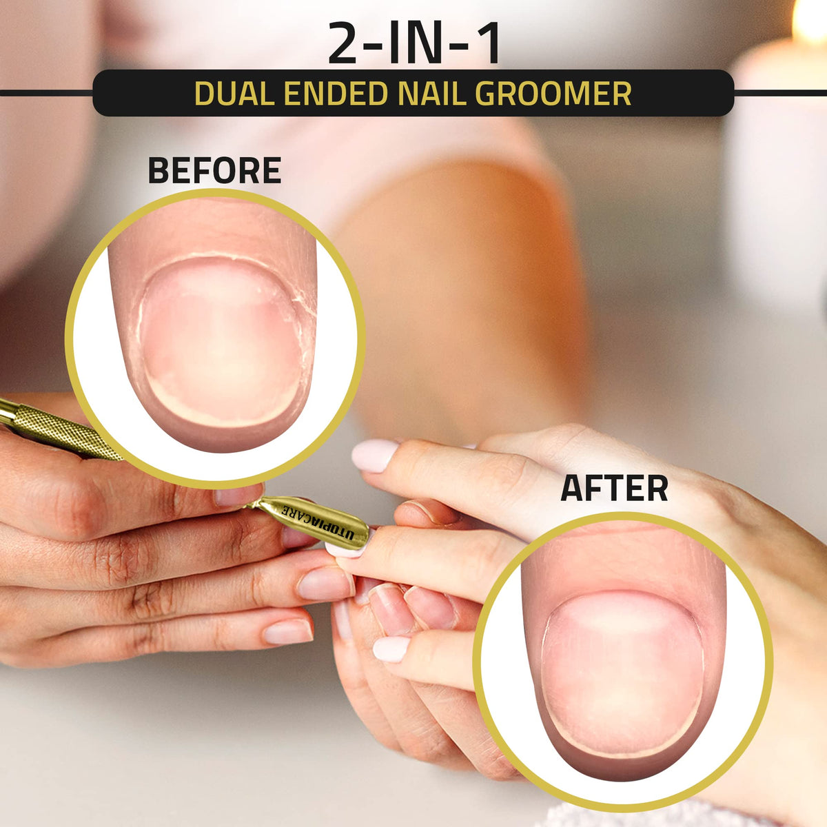 Utopia Care Cuticle Pusher Tool knife-like end for nail cleaning