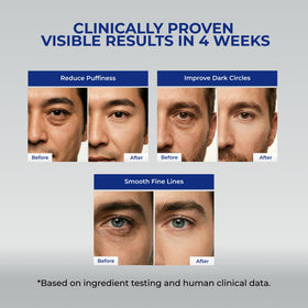 Uttse Men’s Anti Aging Eye Cream application on skin