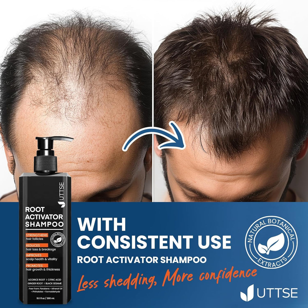 Uttse Root Activator Shampoo 408g packaging details