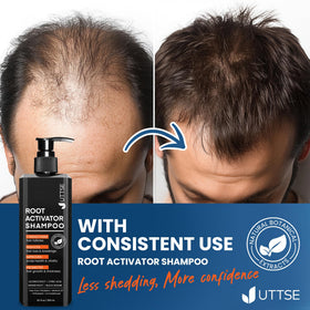 Uttse Root Activator Shampoo for Men with scalp care focus