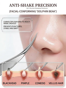 UWOIST blackhead remover kit with spatula and tools