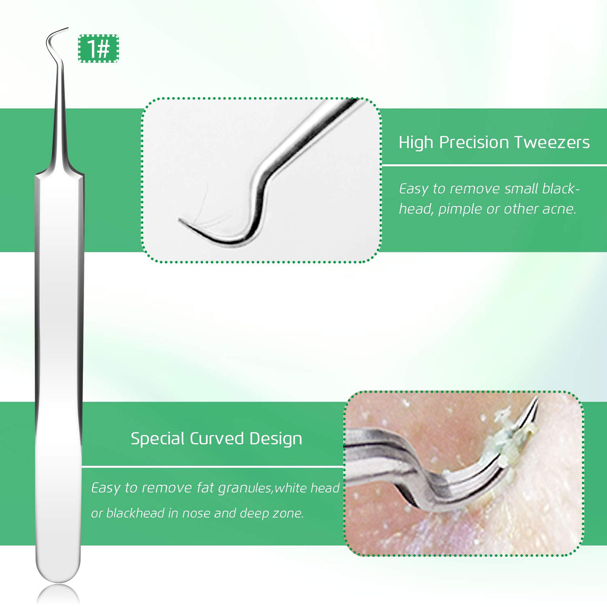 UWOIST blackhead remover tools with dual head design