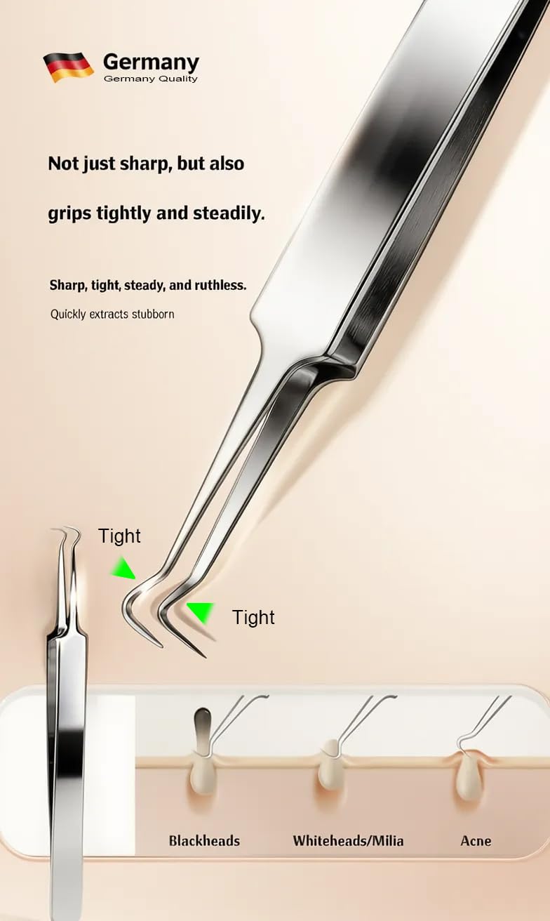 UWOIST pimple popper tool kit for effective skincare