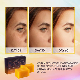 VALITIC Kojic Acid Soap Bars packaging with 5 bars
