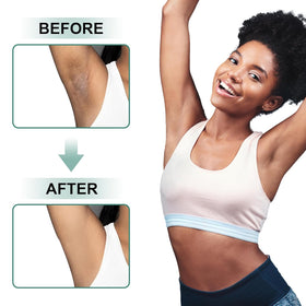 Vcetree Skin Bleaching Cream in bathroom setting