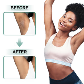 Vcetree Skin Bleaching Cream with other skincare products