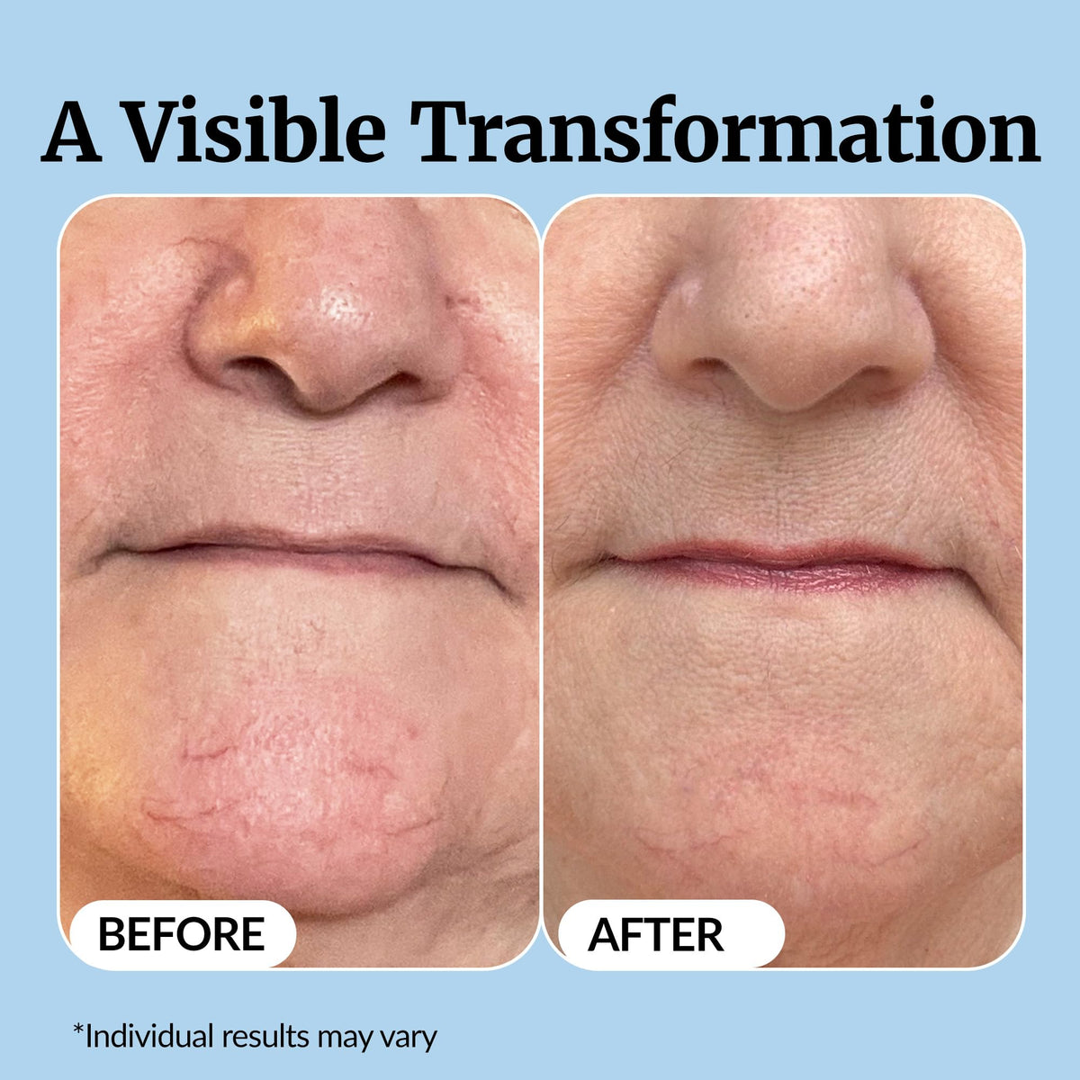 Vibriance Super C Serum ingredients list