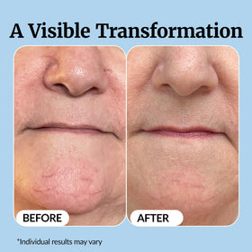 Vibriance Super C Serum ingredients list