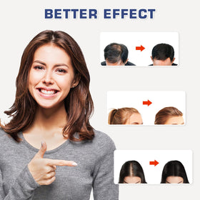Viconor Laser Hair Growth Cap side view