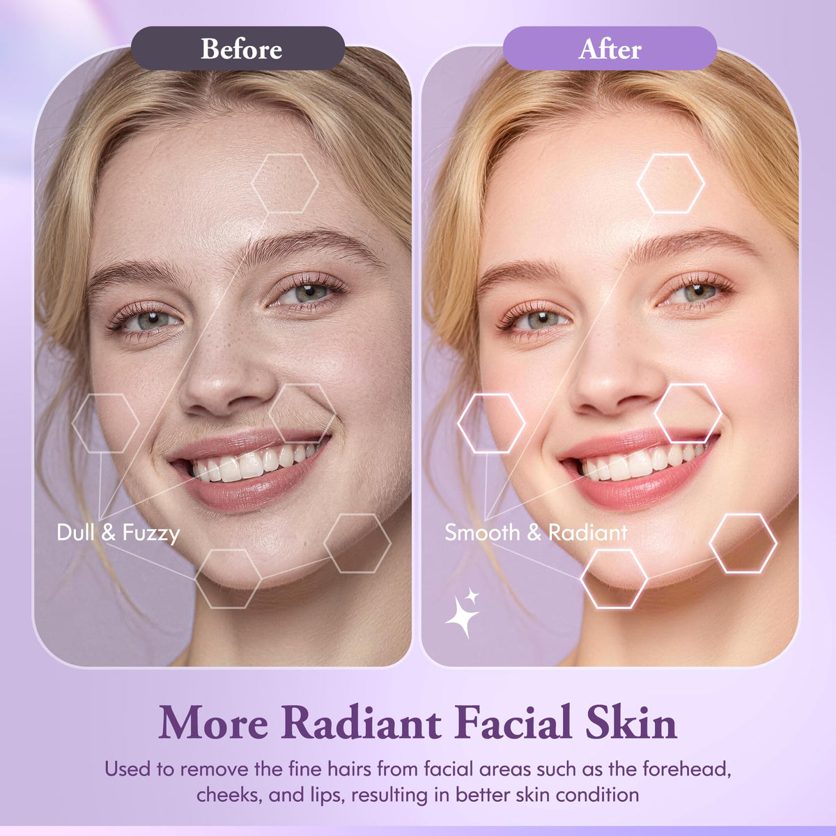 Vidttly Dermaplaner Razor showing LED light feature