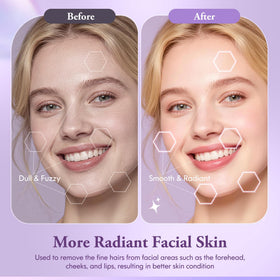 Vidttly Dermaplaner Razor showing LED light feature