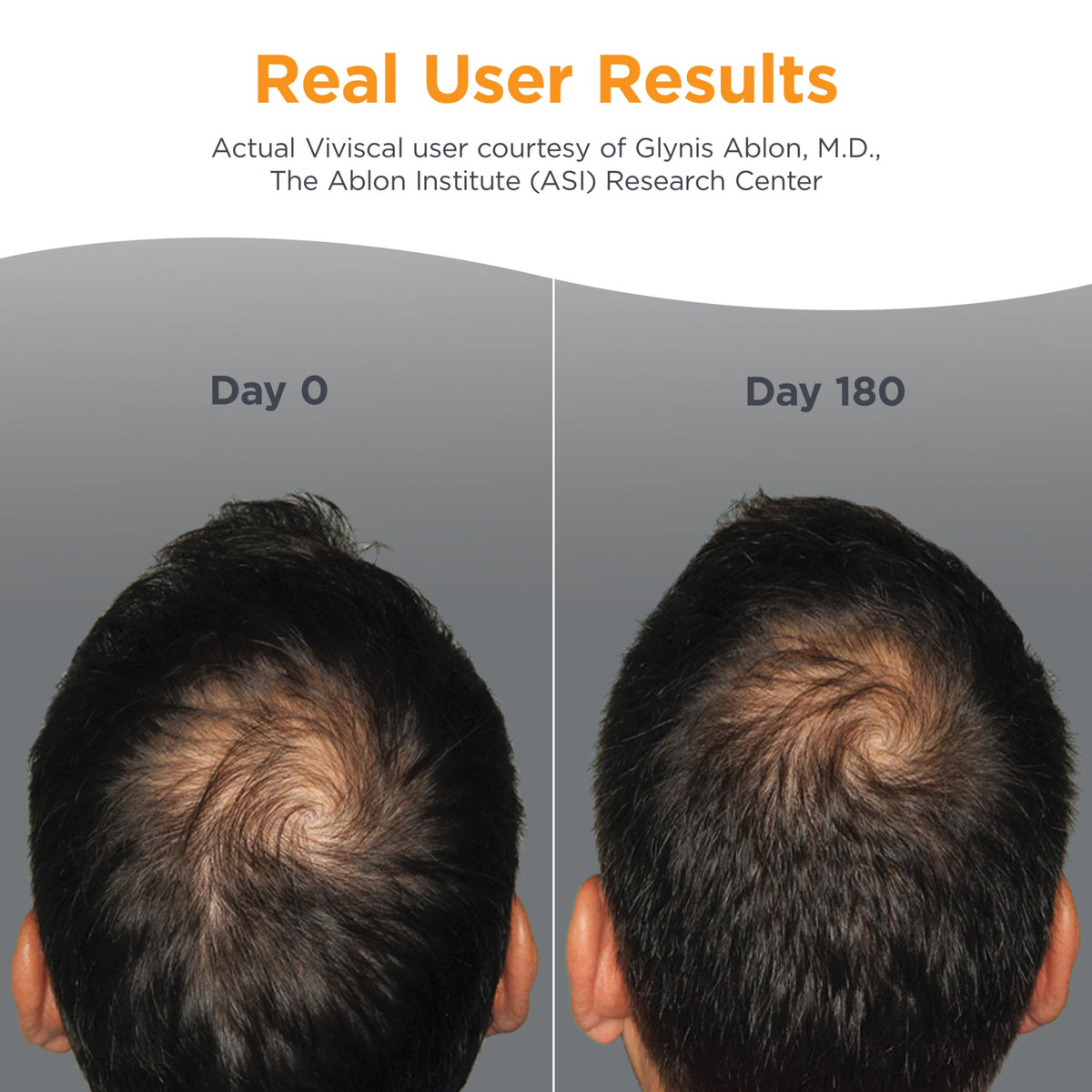 Viviscal Men's Hair Growth Supplements packaging side view