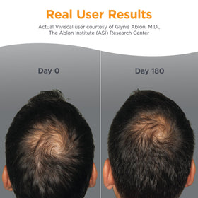Viviscal Men's Hair Growth Supplements packaging side view