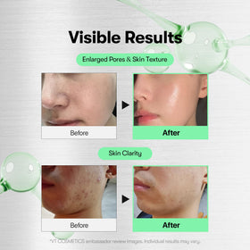 VT COSMETICS CICA Reedle Shot Microneedling Serum 30ml side view