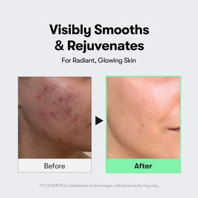 VT COSMETICS CICA Reedle Shot Microneedling Serum close-up