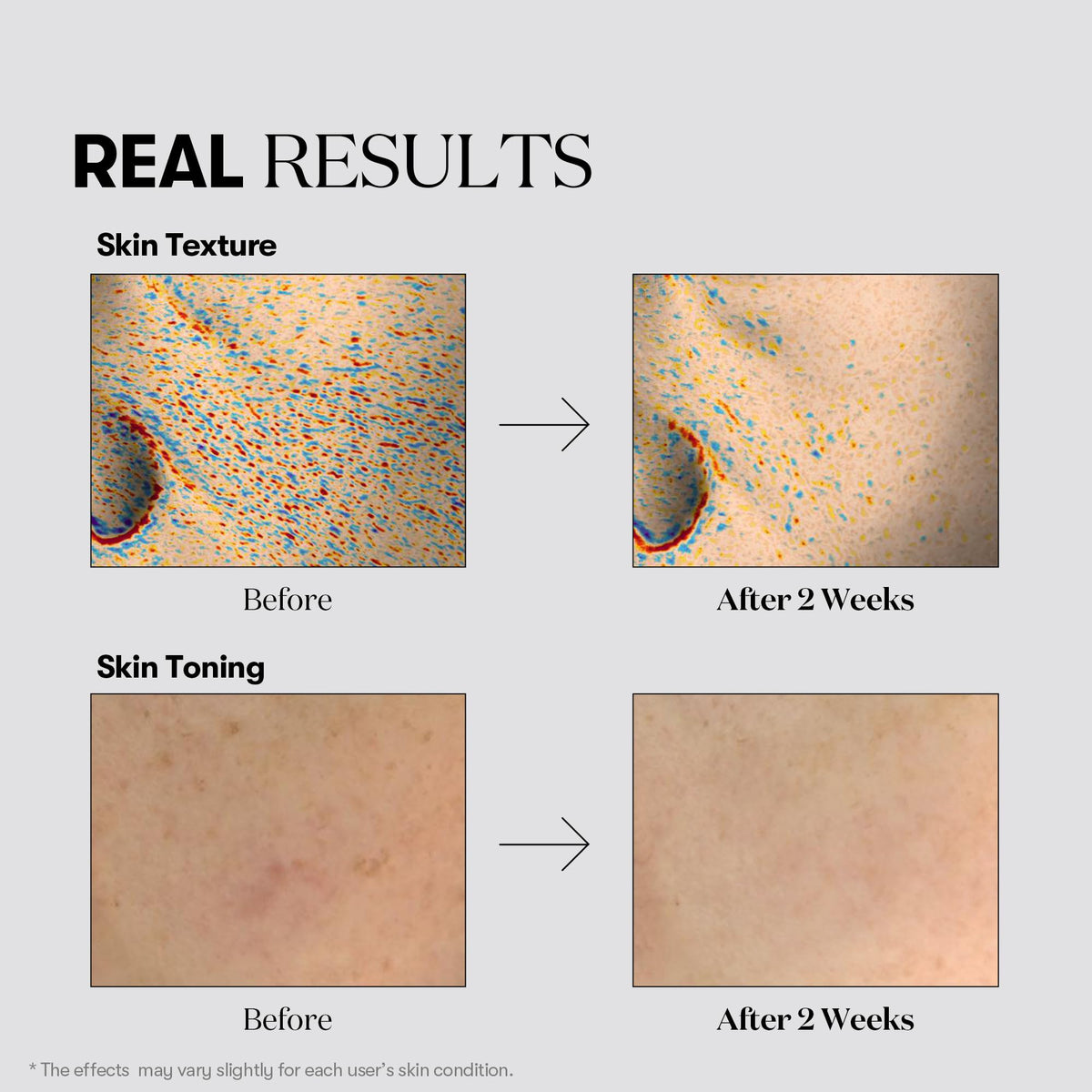 VT COSMETICS TX Toning Daily Mask being applied to a face