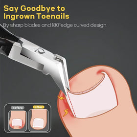 Wanmat toenail clippers set in elegant storage case