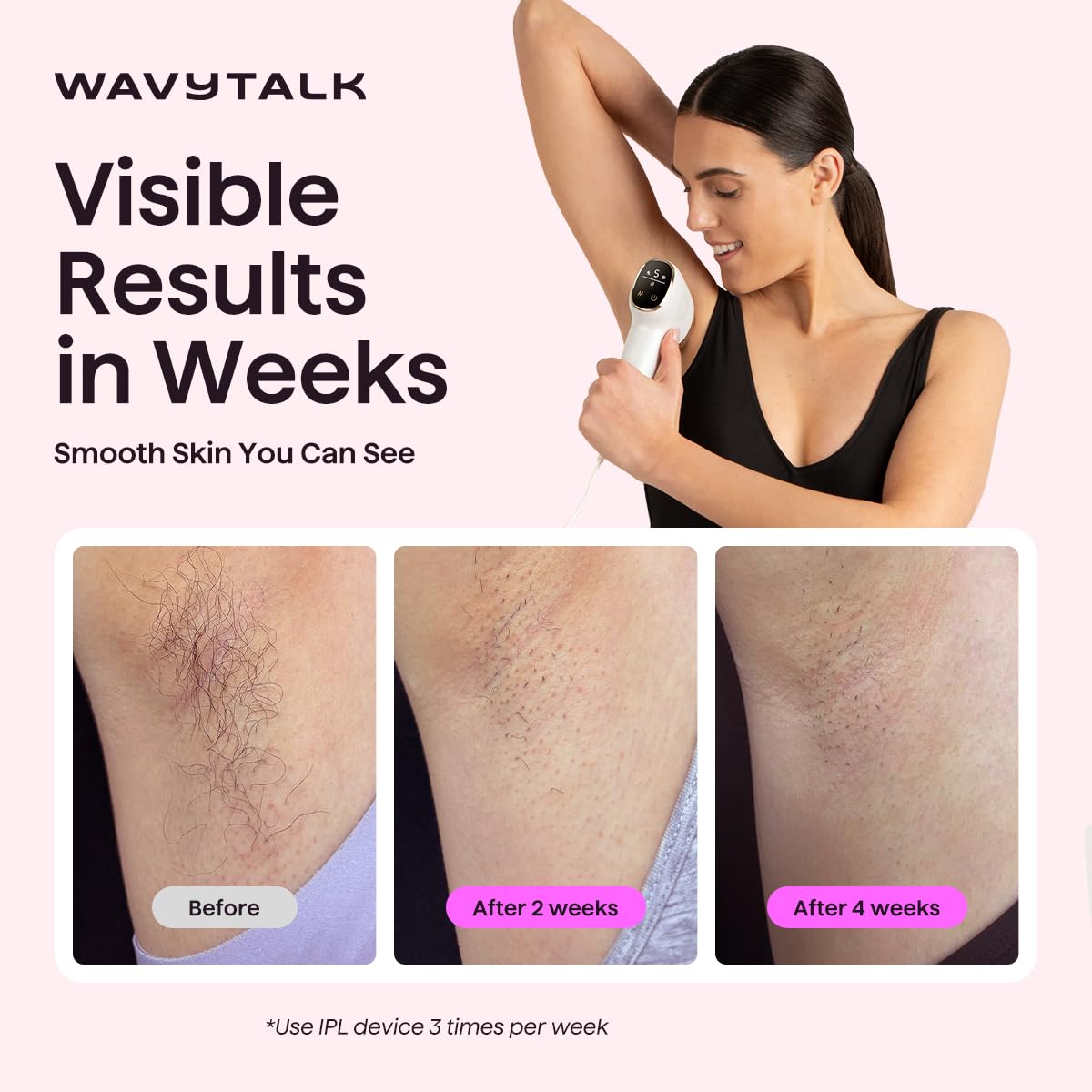 Wavytalk IPL Hair Removal Device side view