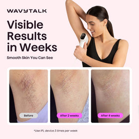 Wavytalk IPL Hair Removal Device side view