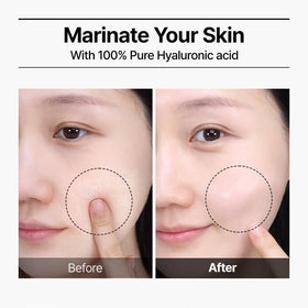 WELLAGE Real HA Blue Ampoule 100 application on skin