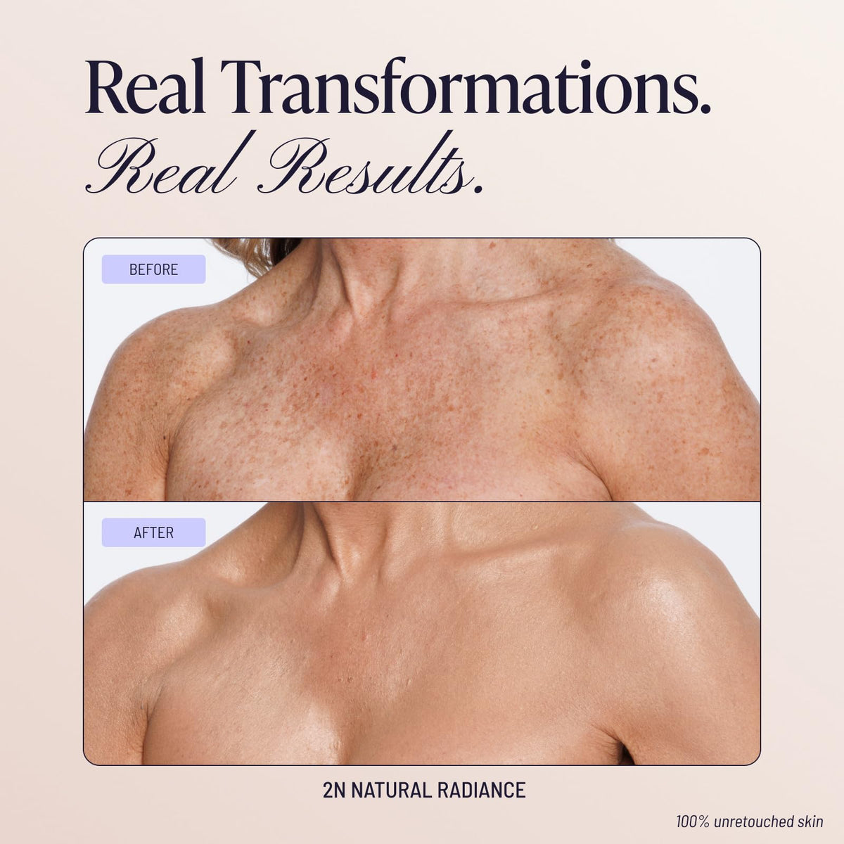 Westmore Beauty Body Coverage Perfector 2N Natural Radiance in use outdoors